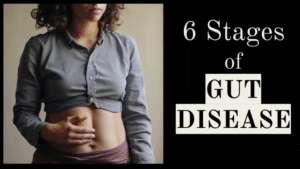 6 Stages of Gut Disease