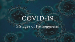 5 Stages of COVID